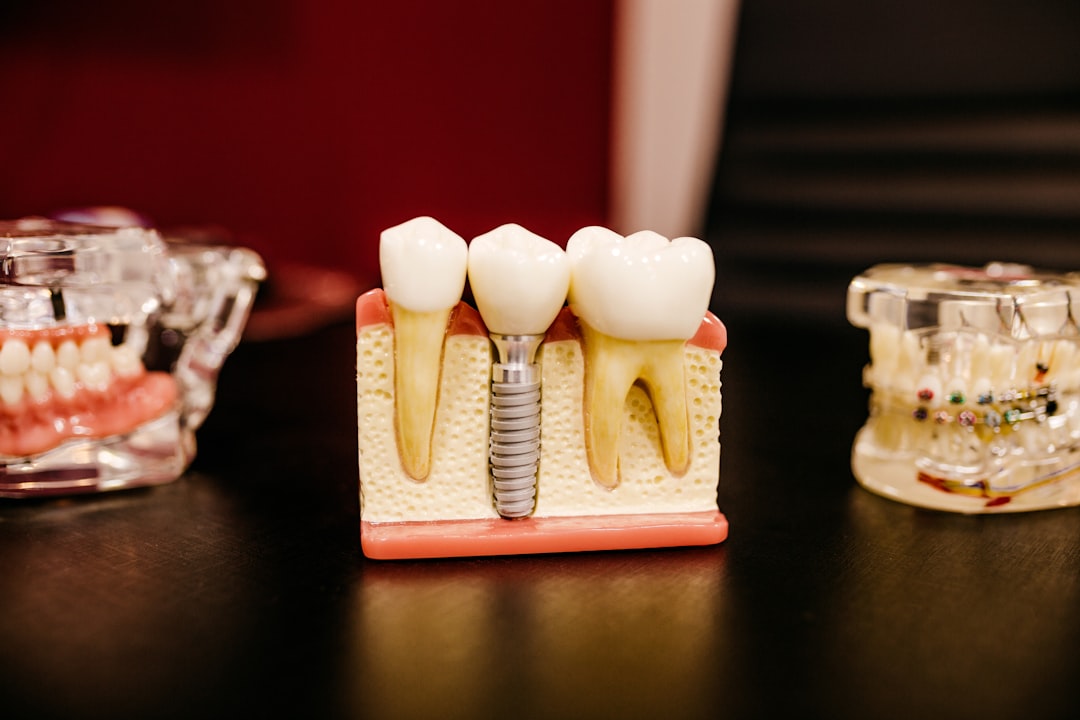 dental-implant-model-with-teeth-w9yey6g8lvm
